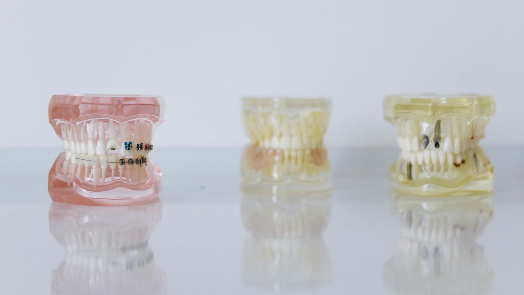 invisalign and braces