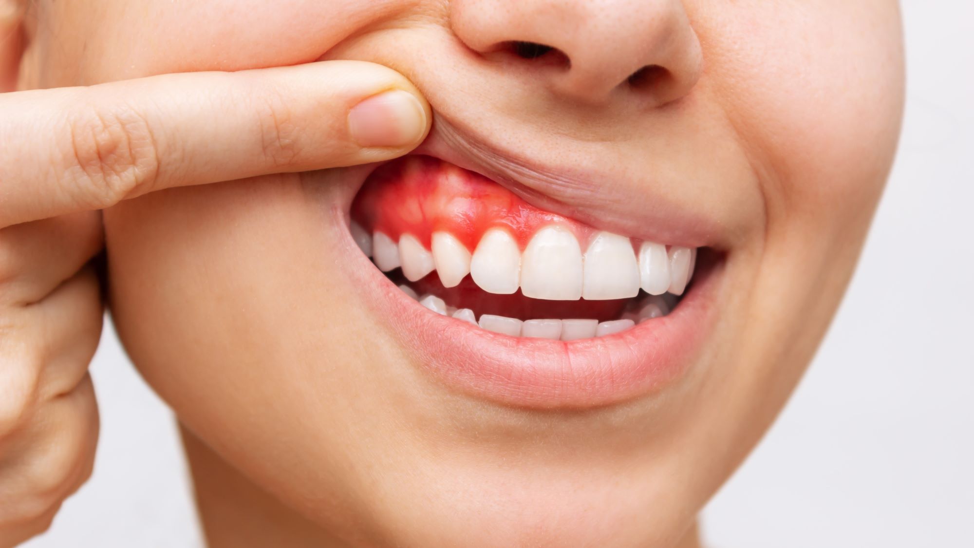 gums